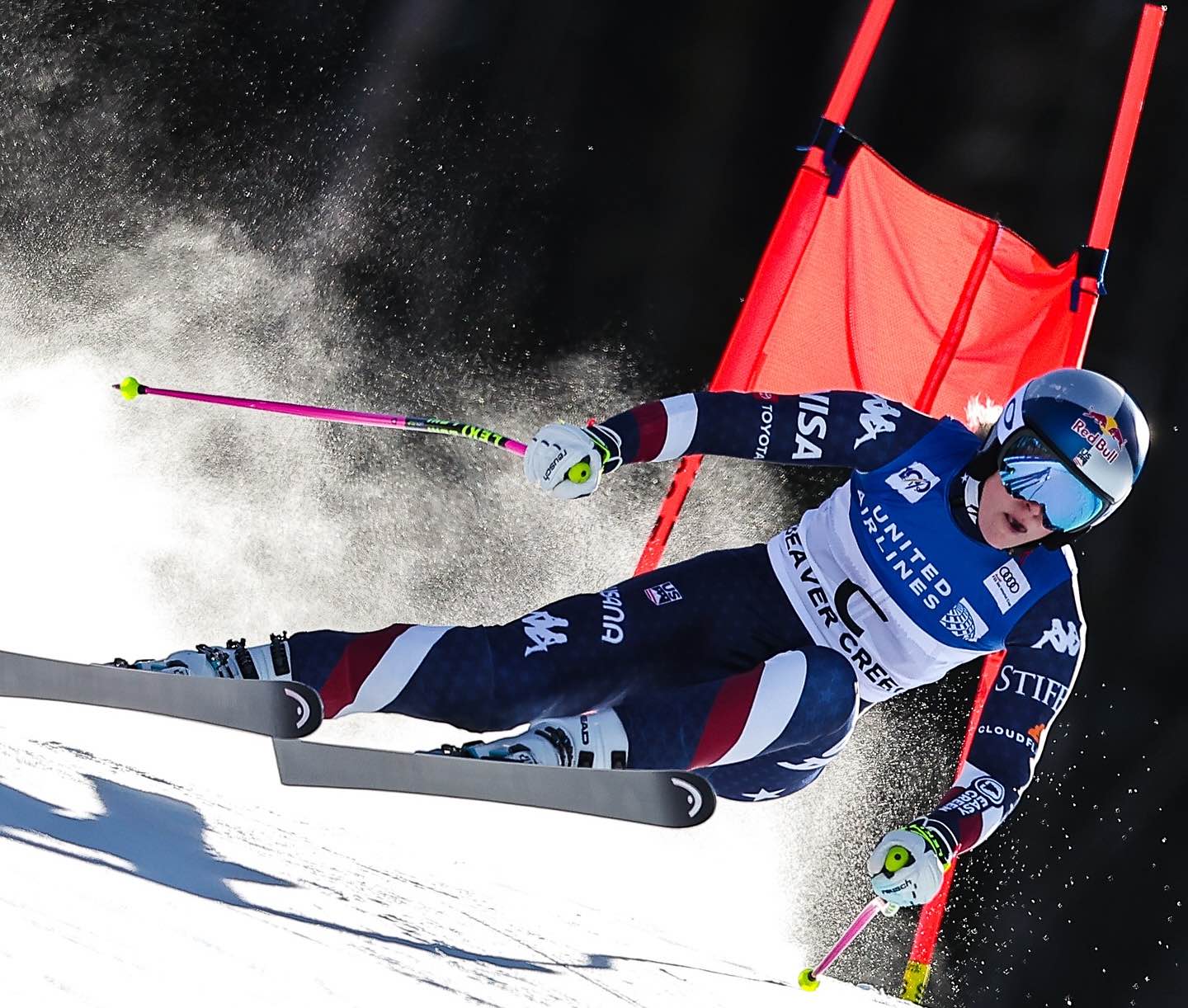 El “milagro” en la rodilla de Lindsey Vonn que le permite volver hoy a esquiar en la Copa del Mundo